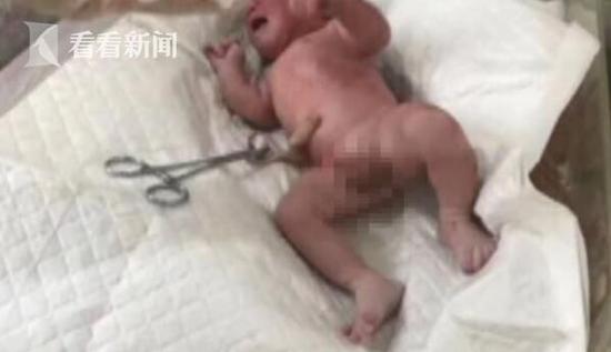男婴出生不到2小时被扔垃圾桶 脐带未剪满脸血