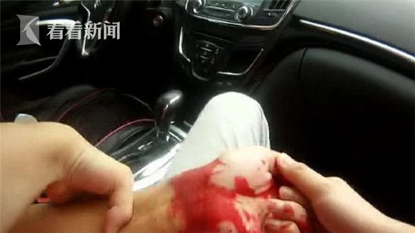 男子为追回前妻割腕自杀 血迹系红墨水伪造