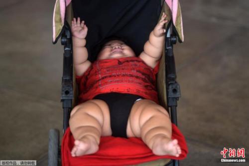 墨西哥10个月大宝宝重达28公斤 或有生命危险(图)