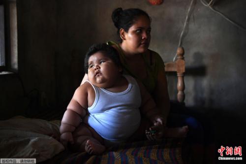 墨西哥10个月大宝宝重达28公斤 或有生命危险(图)