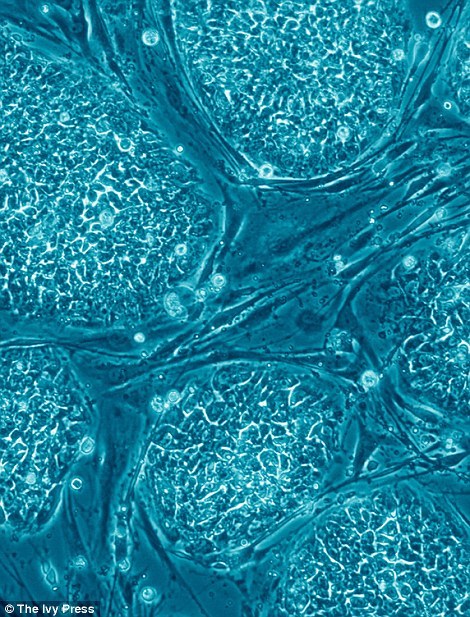 资料图片：培养基中的人体胚胎干细胞，呈现蓝色的球状。