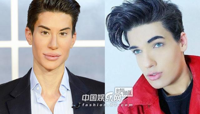 活久见!盘点娱乐圈那些奇葩整容“妖孽”