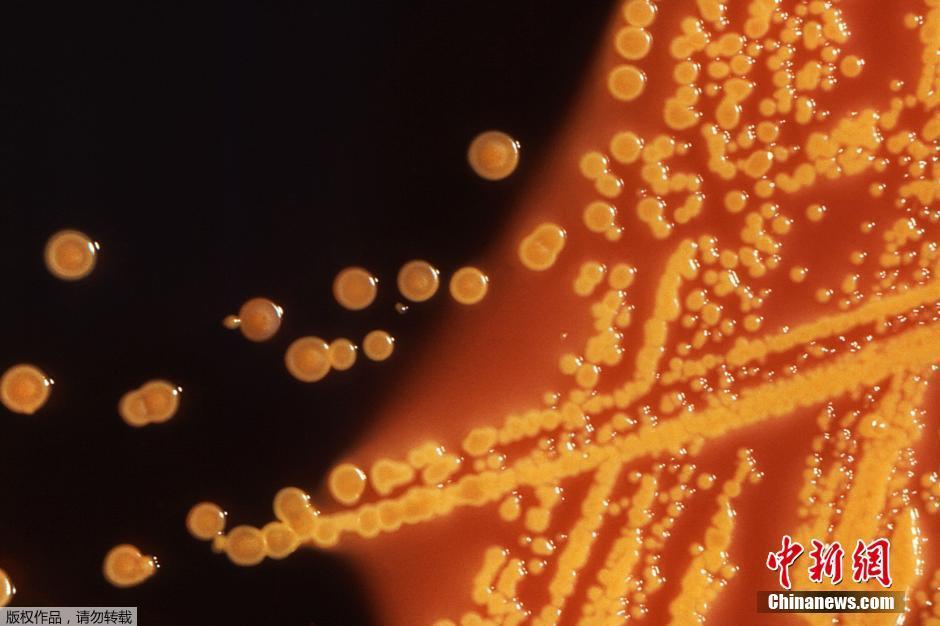 美国发现“超级细菌” 可抵抗所有已知抗生素