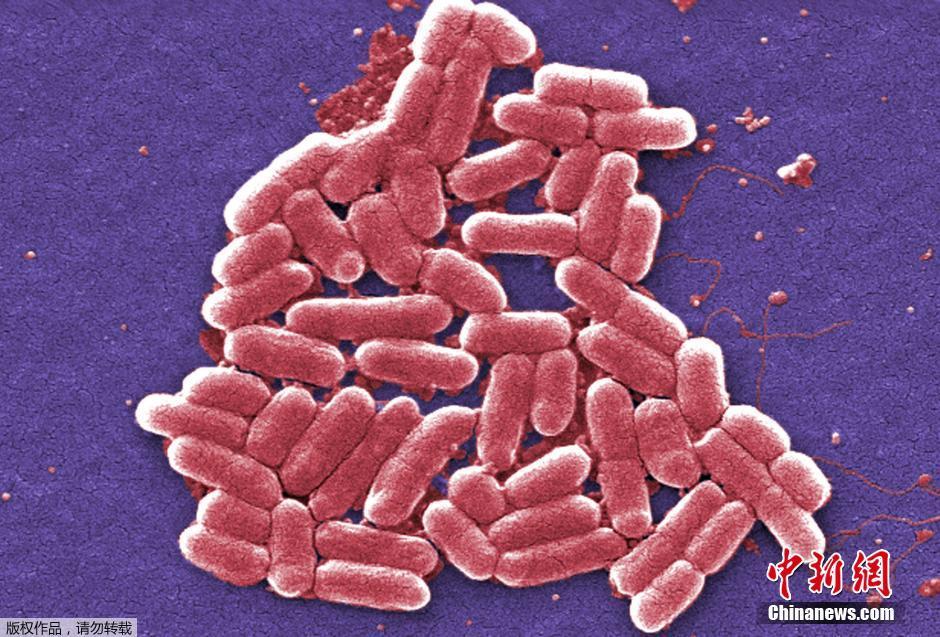 美国发现“超级细菌” 可抵抗所有已知抗生素