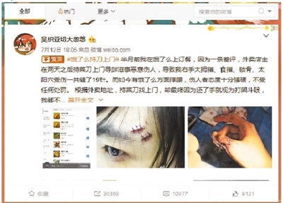 用户在微博上讲述自己被打伤的经过