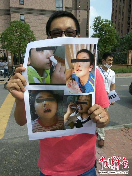  家长在泗泾三小校门外展示孩子流鼻血症状图片。