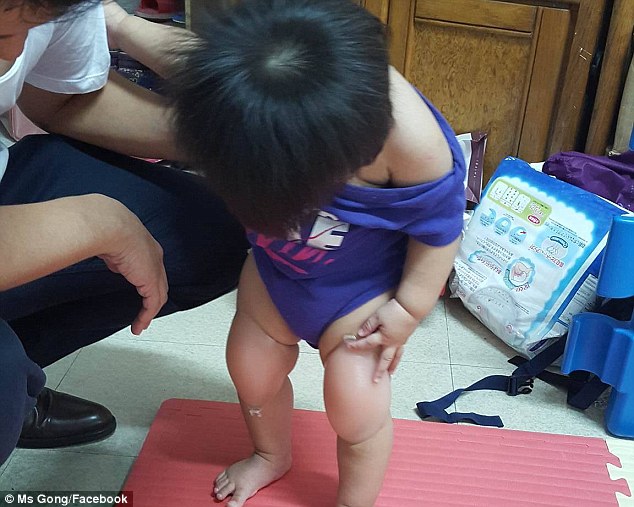 天才！台湾一父亲用老婆内衣给女儿做护膝