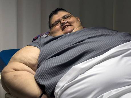 32岁男子重达590公斤 成全球最胖男性(图)