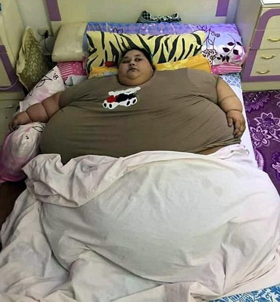 世界最胖女性26天减240斤：曾被起重机吊起送医