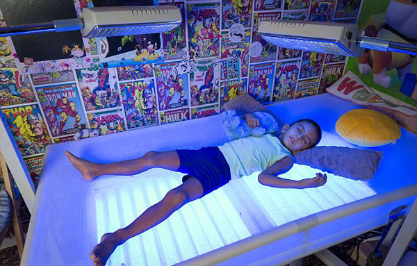 英国4岁男童患怪病 每天需蓝光照射20小时保命