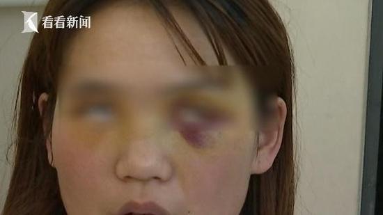 女子割双眼皮后眼睛睁不开 无照医生赔1万失联