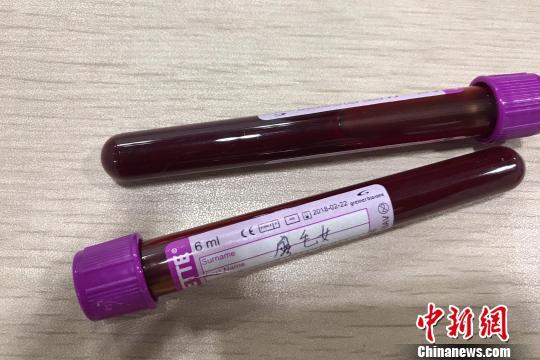 女子带百支孕妇血液制品前往香港欲做性别鉴定
