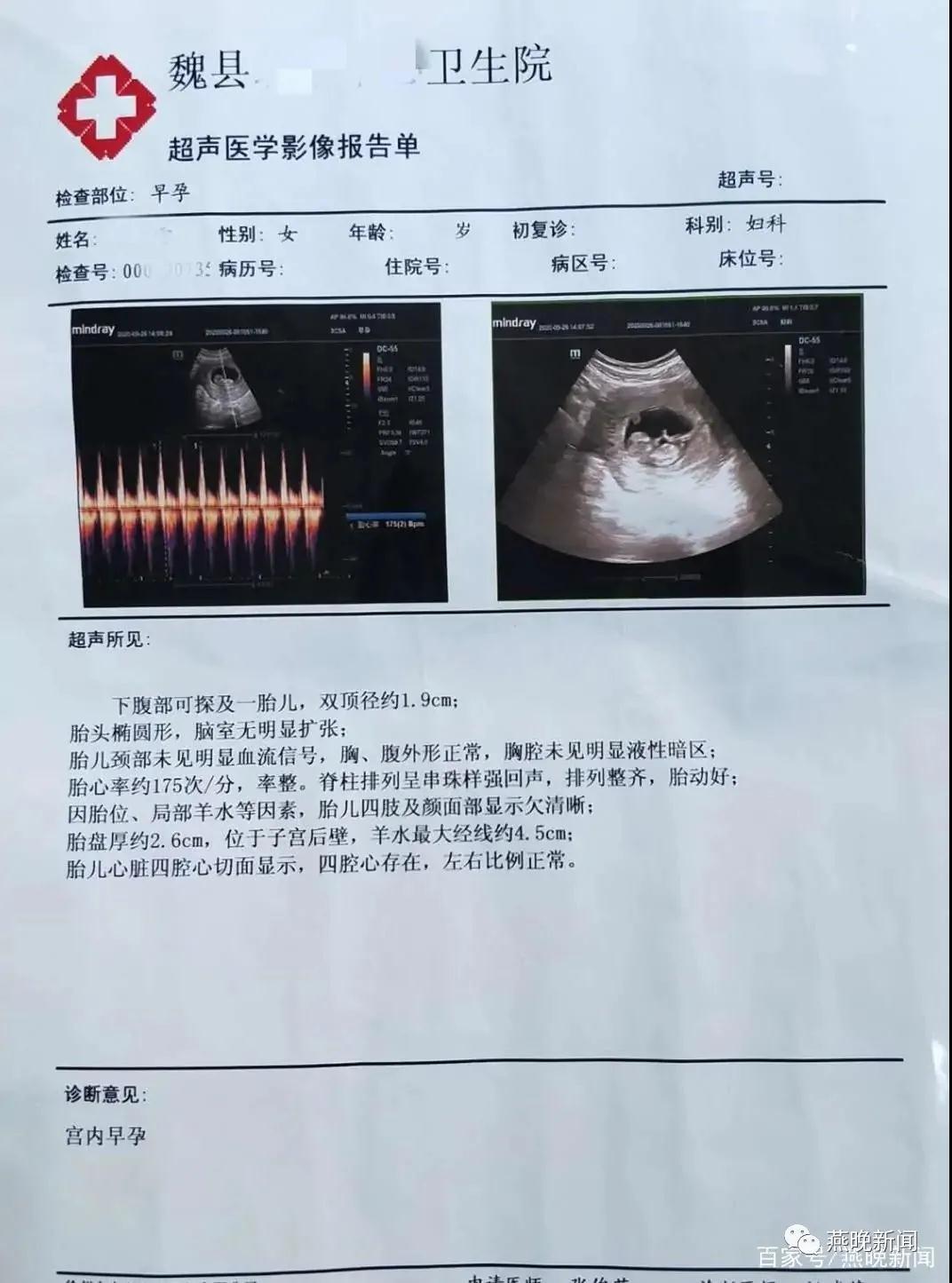怀孕的检查报告单图片图片