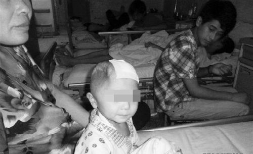 河南一4岁男童被继母“打瘪”半边脑袋(图)