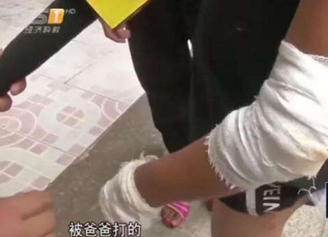 未成年姐弟被生父继母虐打：干不完活用尿浇身