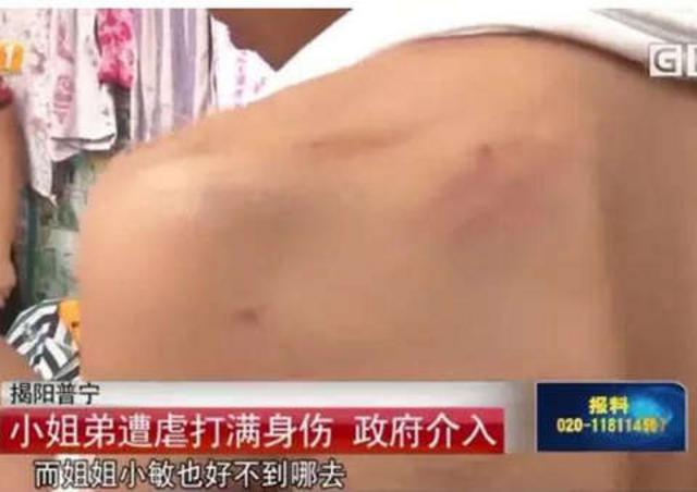 未成年姐弟被生父继母虐打：干不完活用尿浇身