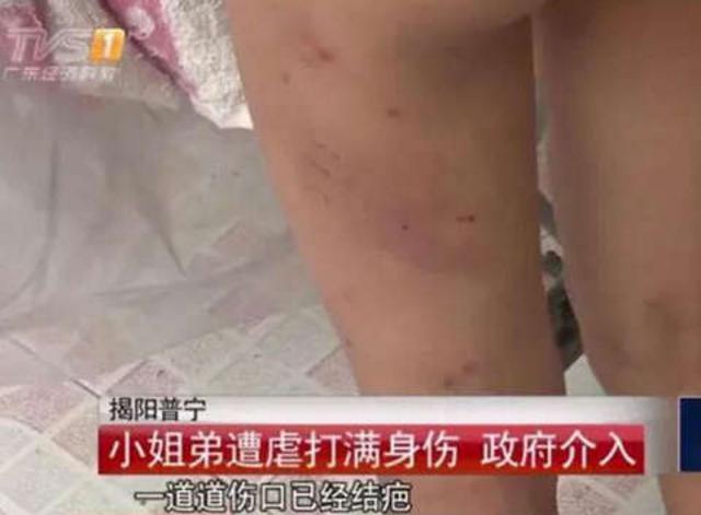 未成年姐弟被生父继母虐打：干不完活用尿浇身