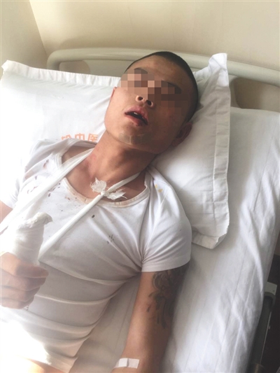 3日，张先生躺在医院病床上，全身到处是伤。