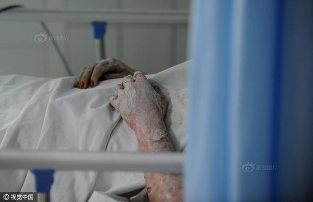 小区突发爆炸 女租户被炸下5楼上身赤裸(图)