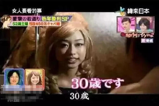 52岁大妈花450万整成少女 为做小姐动刀20次(图)