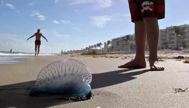 洗海澡被海蜇蜇伤应咋办?千万别用淡水冲(组图)