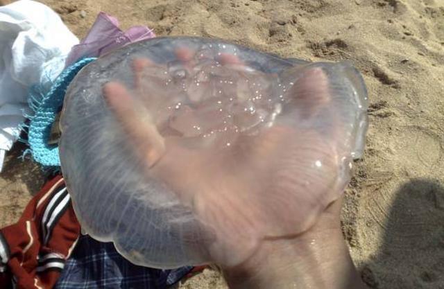 洗海澡被海蜇蜇伤应咋办?千万别用淡水冲(组图)