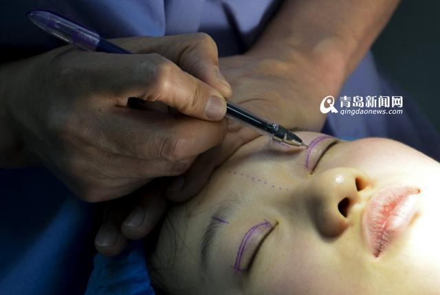 高清：19岁少女要变刘亦菲 独家揭秘整容全过程