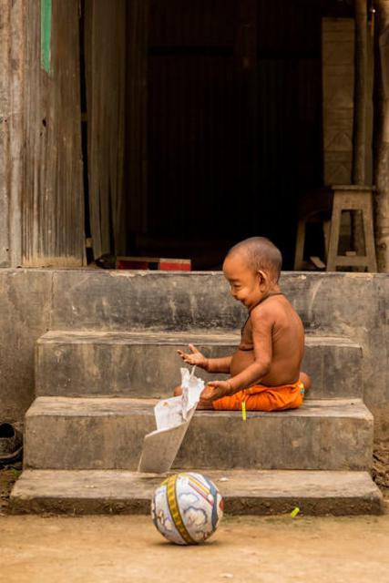 现实版《返老还童》：印度四岁男孩面容宛如老翁