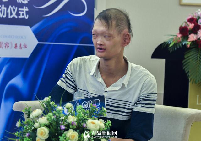 青岛学霸大学生有张“外星脸” 想整形改变命运