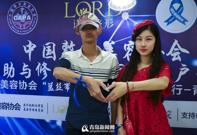青岛学霸大学生有张“外星脸” 想整形改变命运