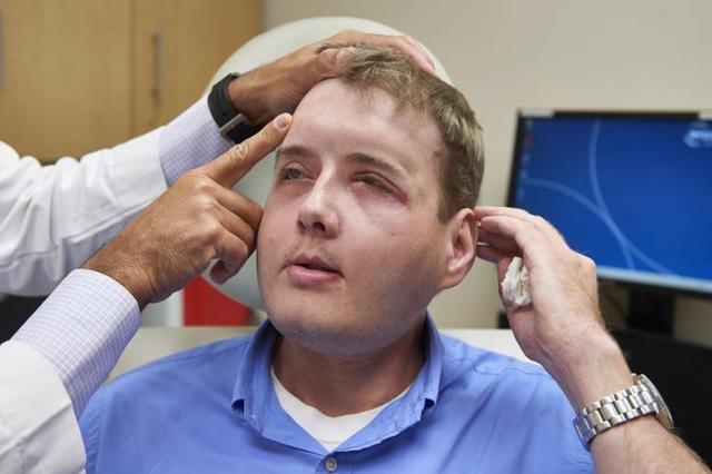 真人版大变脸!美国一毁容消防员换脸成功 真人版大变脸!美国一毁容消防员换脸成功