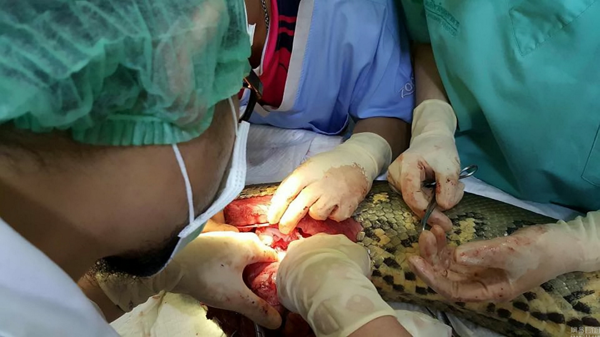 52公斤蟒蛇心脏肿瘤手术 成功切除1公斤肿瘤