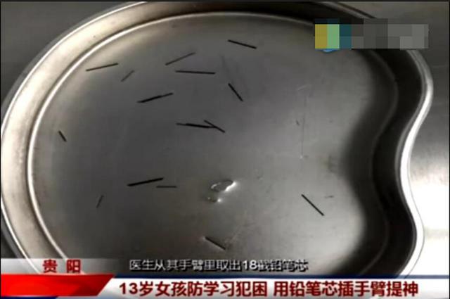 13岁女孩手臂扎18截铅笔芯 为提神做作业(图)