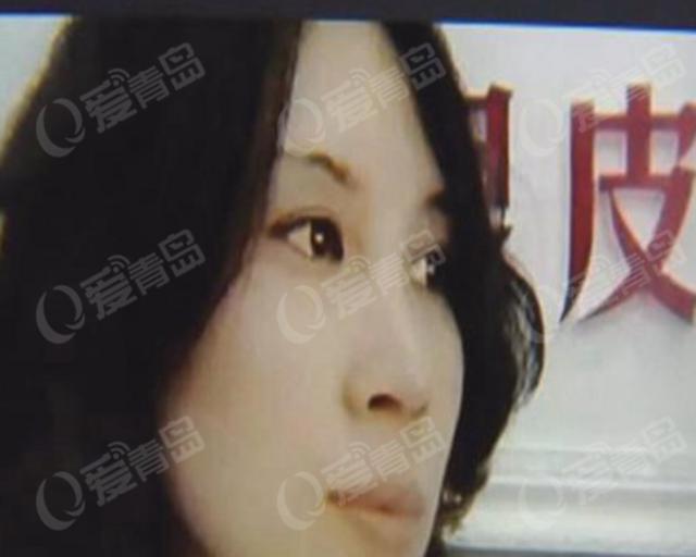 女子微整形变毁容 学员看两次手术就在人脸动刀