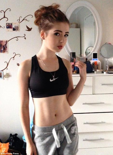 英国女孩患厌食症仅25公斤 靠钢管舞恢复健康 英国女孩患厌食症仅25公斤 靠钢管舞恢复健康