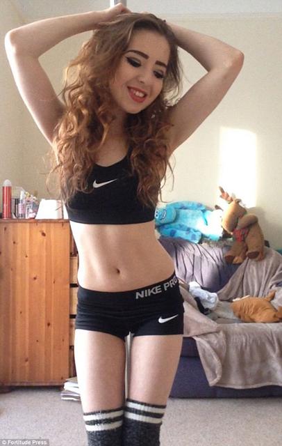 英国女孩患厌食症仅25公斤 靠钢管舞恢复健康 英国女孩患厌食症仅25公斤 靠钢管舞恢复健康