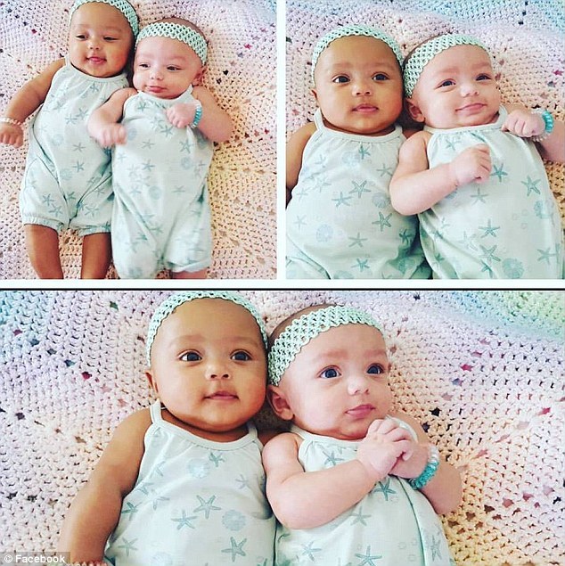 难以置信！美国双胞胎女婴遗传父母不同肤色
