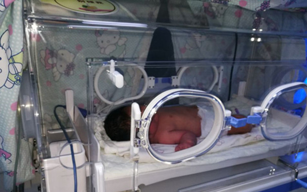 粗心妈妈临产才知怀孕 到医院宝宝已生出一条腿