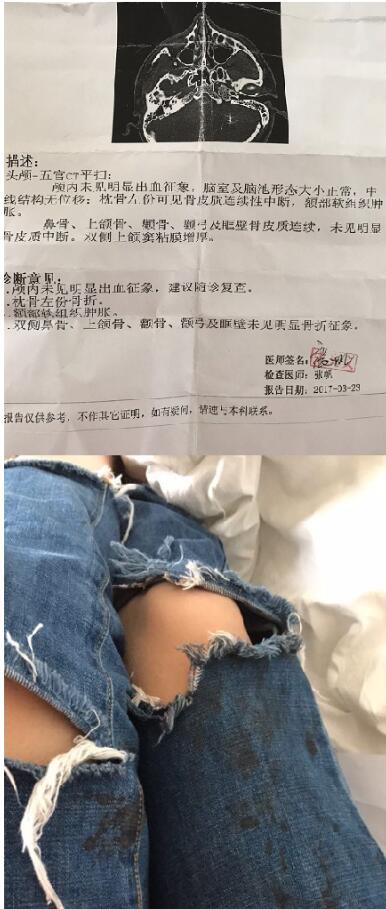 江西游客云南旅游被打 警方：打人者已被抓获