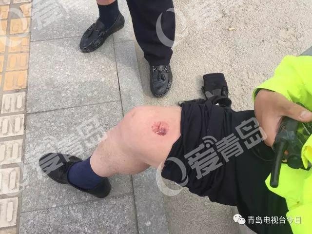 无牌摩托车被查 驾驶员抓住交警大腿就是一口