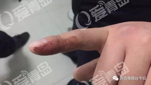 无牌摩托车被查 驾驶员抓住交警大腿就是一口