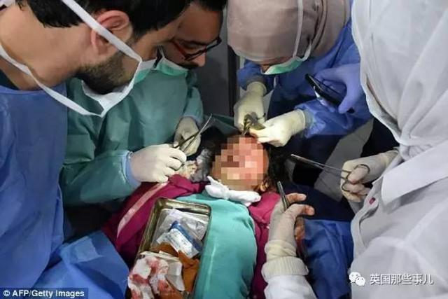 叙儿童受薯片引诱被炸死 摄影师飞奔抢救跪地痛哭