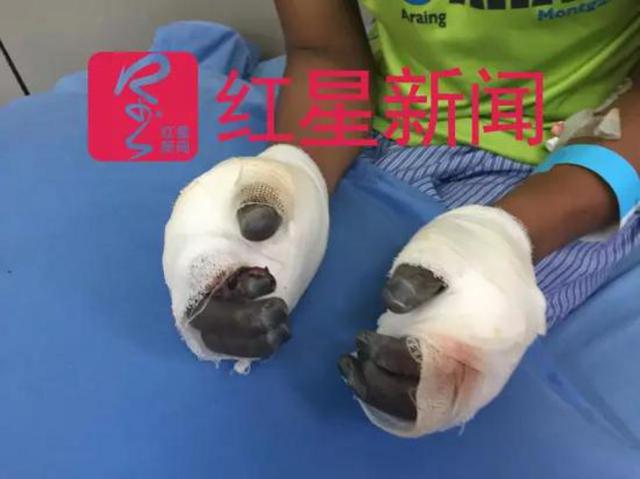 桑吉的十个手指头可能难以保留