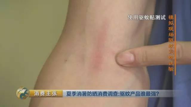 你家的驱蚊产品真有用吗 人肉测试来揭晓