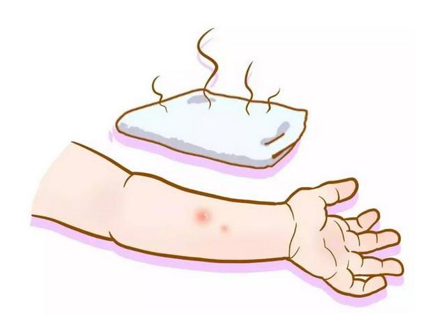 你家的驱蚊产品真有用吗 人肉测试来揭晓