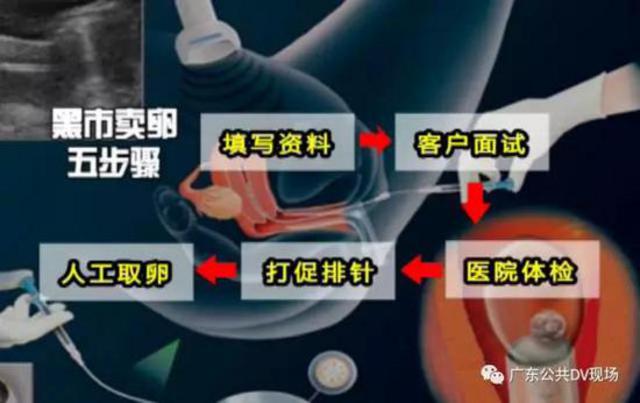广州卖卵黑市:少女卖卵一次赚1.5万 有人险丢命