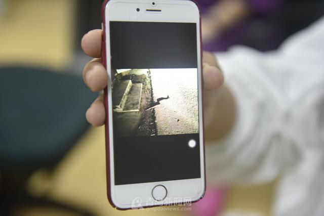 独家：2岁女童在青被毒蛇咬伤 抢救5天捡回命