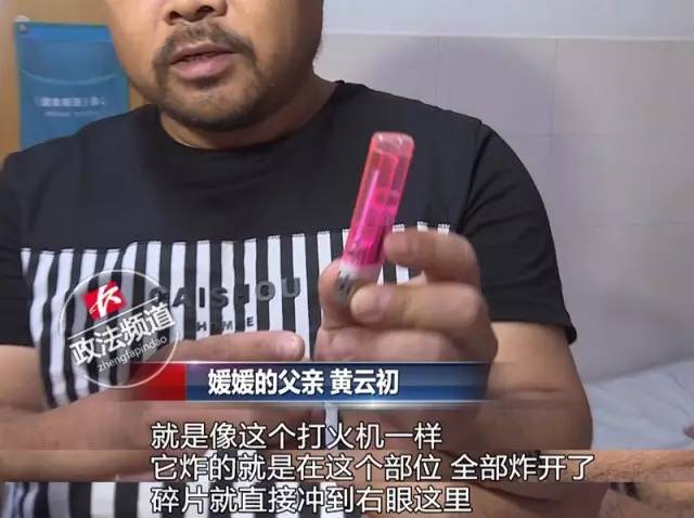 5岁女孩沙发看电视 茶几上打火机爆炸差点失明