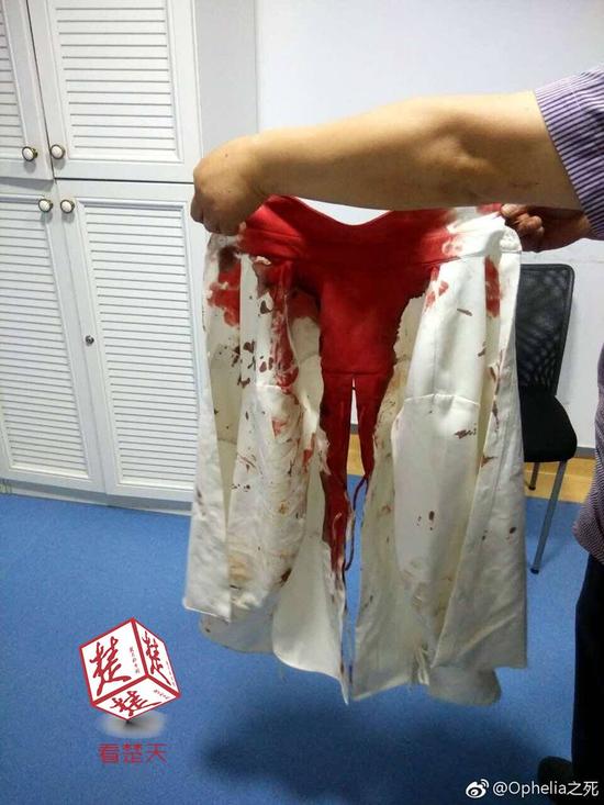 女游客称在昆明遭陌生男追打 满脸是血被缝6针