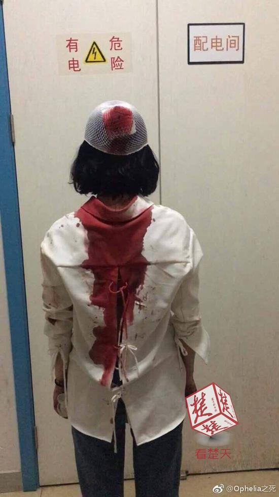 女游客称在昆明遭陌生男追打 满脸是血被缝6针